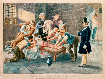 Patriootti ja Carbonerian (Carbonarismin) jäsen Pietro Maroncelli (1795-1846) amputoitiin jalkansa vankilassa Spielbergin linnoituksen katumuslaitoksessa Määrissä. 1800-luvun Museo del Risorgimenton grafiikkaa, Milano tekijältä Italian School