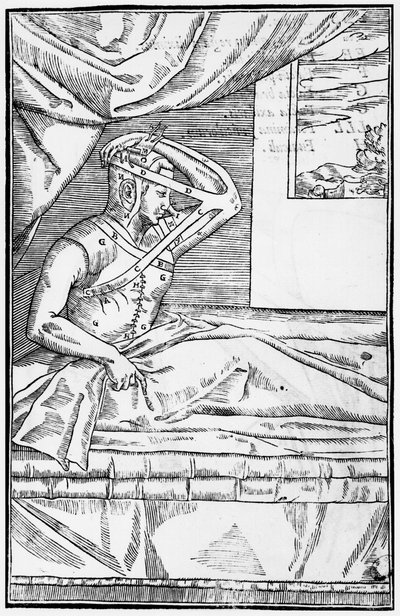 Nenän korjaava leikkaus, kuva teoksesta De curtorum chirurgia per insitionem, Gaspare Tagliacozzi (1545-99) Venetsia, julkaistu 1597 tekijältä Italian School