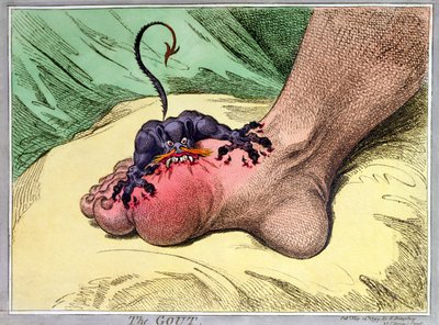 The Gout, julkaissut Hannah Humphrey vuonna 1799 (käsinvärinen softdground-etsaus) tekijältä James Gillray