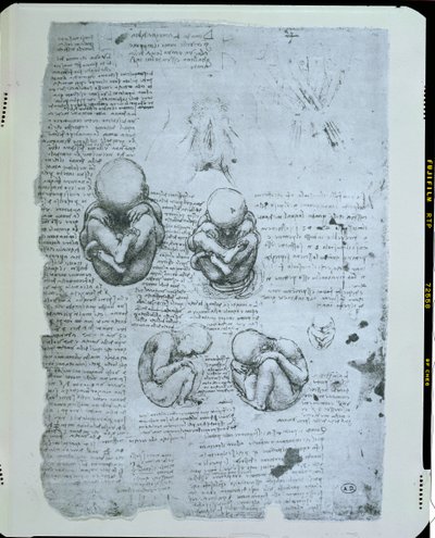Viisi näkymää kohdussa olevasta sikiöstä, faksikopio tekijältä Leonardo da Vinci