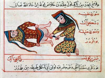 Lääketiede: hermafodiitin leikkaus. Miniatyyri Sharaf al-dinin turkkilaisen lääketieteen kohteesta tekijältä Ottoman School