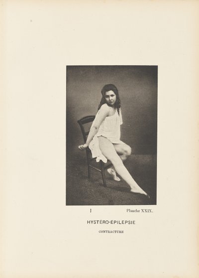 Hystero-epilepsiakontraktuura tekijältä Paul Marie Léon Regnard