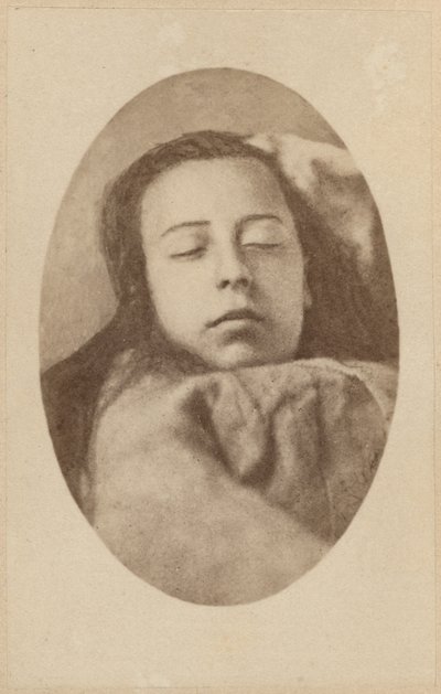 Hysteriakohtaus, toinen vaihe, kuvitus Bournevillen ja P:n julkaisemasta "Iconographie Photographique de La Salpetriere". Regnard, levy III, Pariisi, 1876 (valkopainatus). tekijältä Paul Regnard