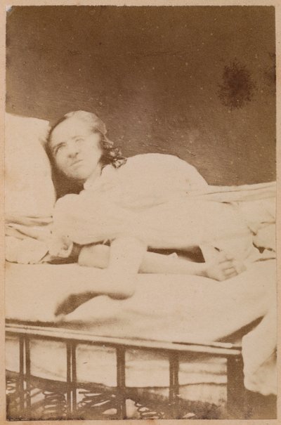 Hysteerinen epilepsia, vääntymät, levy XXXVIII Bournevillen ja P. Regnardin teoksesta "Iconographie Photographique de La Salpetriere", Pariisi, 1876 (albumiprintti) tekijältä Paul Regnard