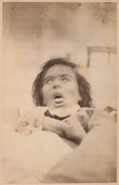 Hysteerinen epilepsia, hallusinaatiot, ahdistus, levy XXIX Bournevillen ja P. Regnardin teoksesta "Iconographie Photographique de La Salpetriere", Pariisi, 1876 (albumiprintti) tekijältä Paul Regnard