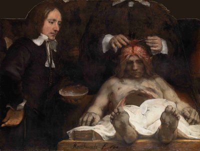 Tohtori Jan Deijmanin anatomiatunti, 1656 tekijältä Rembrandt van Rijn