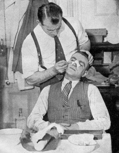 Englannin kapteeni Eddie Hapgood saa hoitoa murtuneesta nenästä vuoden 1934 Italian-ottelun jälkeen. tekijältä Topical Press Agency