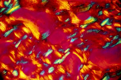 BIO-MATERIAALIT, LM Bone tekijältä Unbekannt