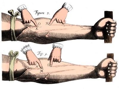 Verenkierto, 1628 tekijältä Unbekannt