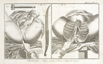 Varusteet, Early-Modern tekijältä Unbekannt