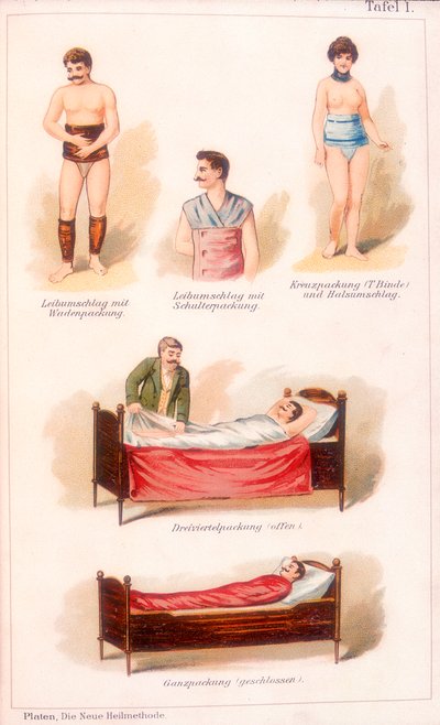 Vesiterapiahoidot, c1902 tekijältä Unbekannt