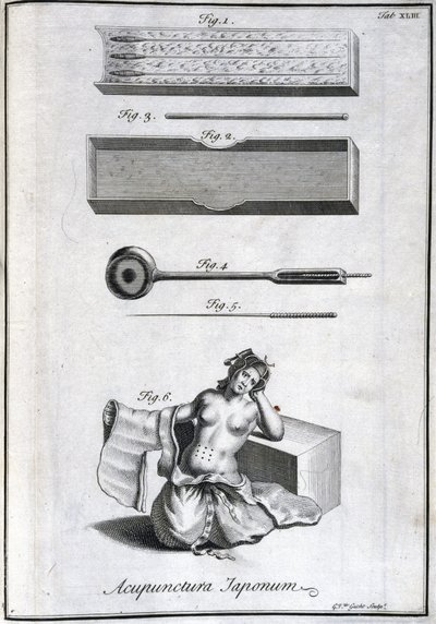 Vaihtoehtoinen lääketiede: akupunktioneuloja esittävä levy ja niiden käyttö, kaiverrus Engelbert Kaempferin (1651-1716) teoksesta "Japanin historia" (1727) (Akupunktioneulat ja niiden käyttö, n. 1690 G van der Guchtin kaiverrus kuva tekijältä Unbekannt