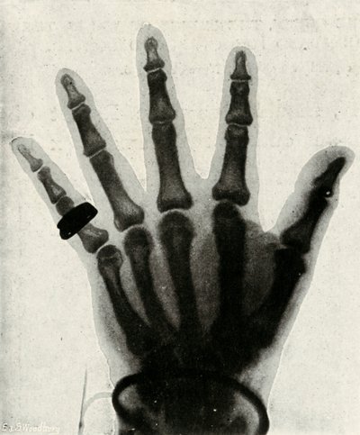 H.R.H.:n käden röntgenkuva Walesin prinssi, 1897 tekijältä Unbekannt