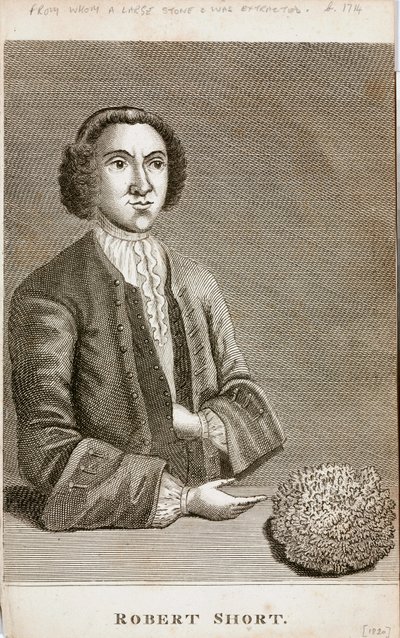 Robert Short, lääketieteellinen uteliaisuus, n. 1750-luku tekijältä Unbekannt