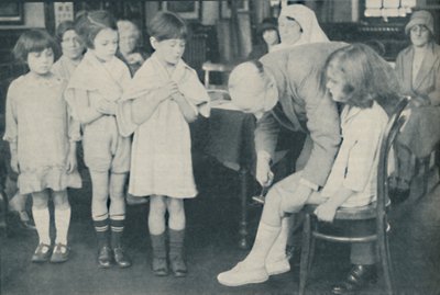 Polvilumpion refleksin testaus hermostosairauden varalta, c1935 tekijältä Unbekannt