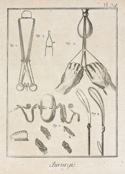 Laitteet, Early-Modern Kirurgiset instrumentit ja laitteet tekijältä Unbekannt