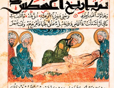 Keisarinleikkauksen esitys. Miniatyyri otettu Abu Raihan Al-Birunin (tai Alberunin) (973-1048), persialaisen intellektuellin ja tiedemiehen lääkekäsikirjoituksesta, folio 161. tekijältä Unbekannt