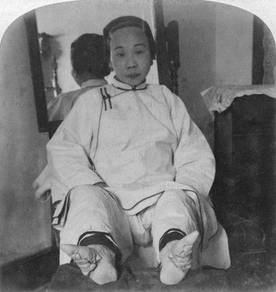 Korkealuokkaiset naisten hienot liljajalat, jotka esittävät epämuodostumia, Kiina, 1900. tekijältä Underwood and Underwood