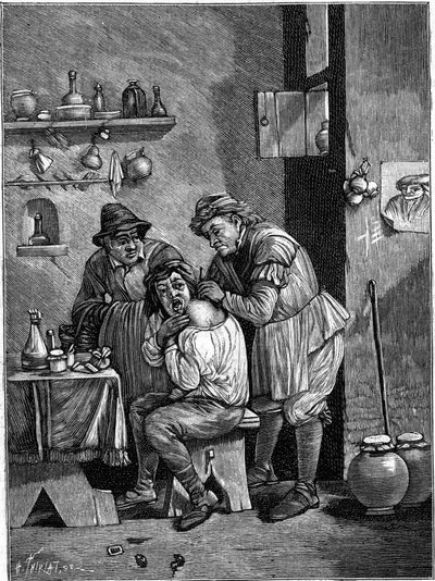 Karlataanikirurgi 1700-luvulla tutkimassa olkapäävammaa. (Ajan kaiverruksesta). Kaiverrus "" La Nature: revue des sciences et de leurs applications aux arts et a l