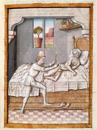 Lääkäri hoitaa miniatyyripotilasta Bidpain "Kalilan (Calila) ja Dimnan" tarinoiden saksankielisestä käännöksestä. (ms. 1389, fol. 23) noin 1480 Chantilly, museo Conde tekijältä Unknown artist