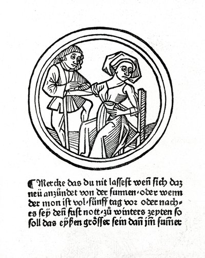 Naisen verenvuoto. Ksylografia Hyeronimus Braunschweigin "Buch de Surgeryssa". Strasbourg 1497 tekijältä Unknown artist