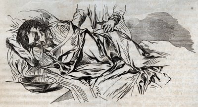 Onnettomuuslääketiede - tehokkaimmasta avustuksesta hukkuneille - pähkinävaipat kyljessä ja juomansa veden oksentaminen - kaiverrus "La Sante Universelle - Guide Medical des Familles" 1852 tekijältä Unknown artist