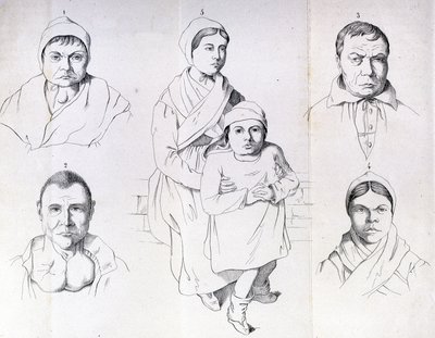 Morelin pohdintoja endeemisen kretinismin syistä. tekijältä Unknown artist