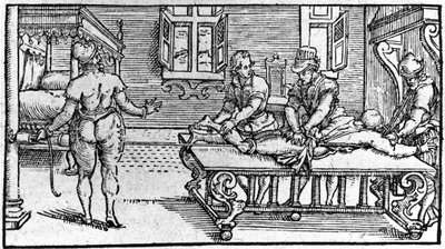Dislokaation vähentäminen - Ambroise Parén teoksessa "Traité Médical", noin 1560. tekijältä Unknown artist