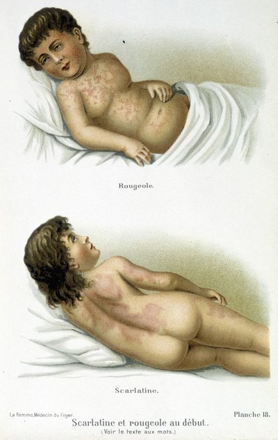 Tulirokko ja tuhkarokko - 1800-luku tekijältä Unknown artist