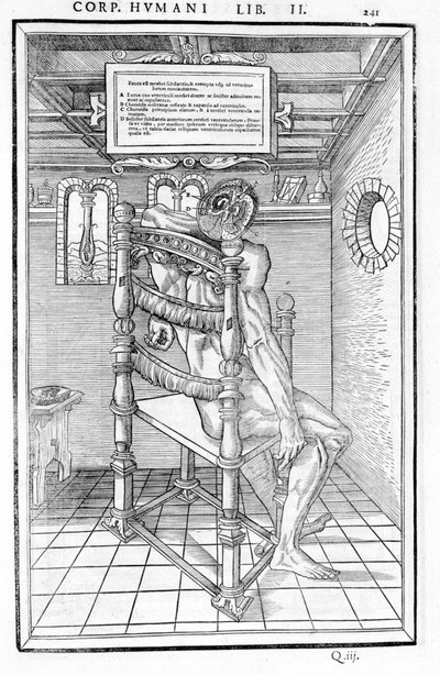 Kallo leikkaus. Anatominen taulu "Ihmiskehon kolmen osan dissektio..." Carlo Stefano Riverio, Pariisi 1545 tekijältä Unknown artist