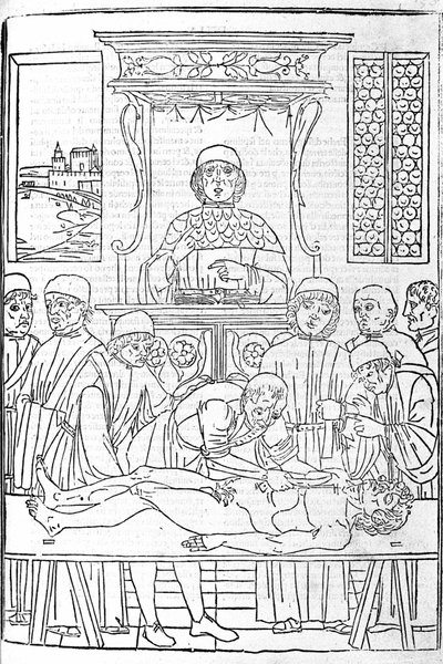 Anatominen dissektio. Kaiverrus Gerolamo Cardanon (Cardanus Hieronymus) lääketieteen tutkielmasta, Firenze tekijältä Unknown artist