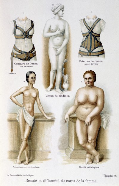 naisen kehon kauneus ja epämuodostumat (laiha ja lihavuus); Junon vyöt - elokuvassa "Nainen, kotilääkäri" tekijältä Unknown artist