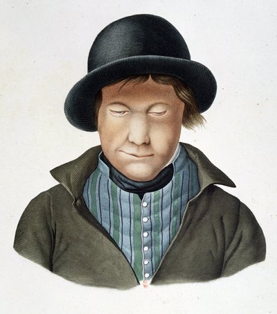 Islannin spitaaliset, noin 1840, B.N. tekijältä Unknown artist