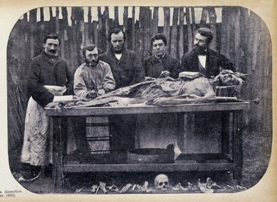 Dissection, v.1865. tekijältä Unknown photographer