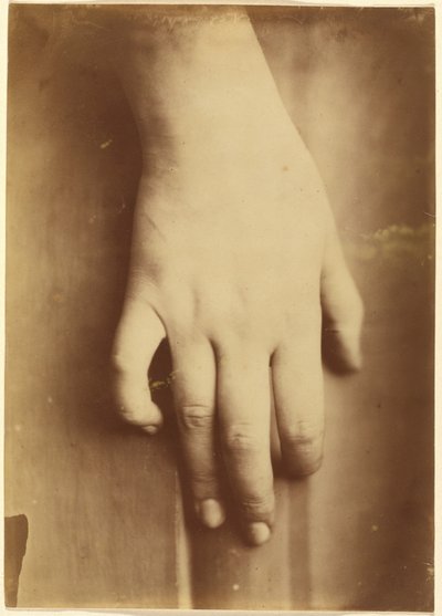 Tutkimus kädestä,1865 (kuva) tekijältä Unknown photographer