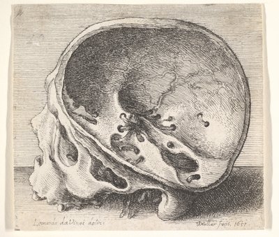 Leikattu kallo profiilissa vasemmalla, kallon vasen puoli poistettu, 1651. tekijältä Wenceslaus Hollar