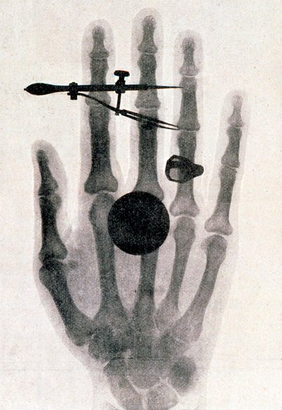 Wilhelm Roentgenin röntgenkuva vaimonsa kädestä, 1896 tekijältä Wilhelm Conrad Rontgen