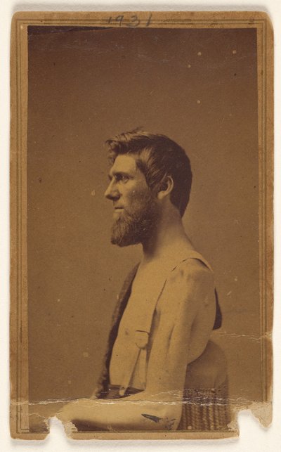 [Tunnistamaton sisällissodan uhri profiilissa, istuu] tekijältä William H. Bell