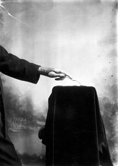 Proteesit Mies, joka käyttää proteettista kättä tekijältä Frederick (attr. to) Barnard