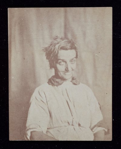 Psykiatria Potilaan muotokuva, Surrey County Asylum, n. 1852 tekijältä John Pardon