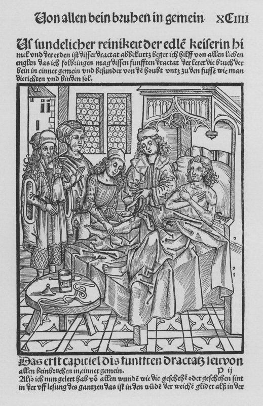 Kirurgian kirja, Hieronymus Brunschwig (litho) tekijältä (after) German School
