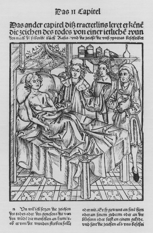 Hieronymus Brunschwigin Kirurgian kirja (litho) tekijältä (after) German School