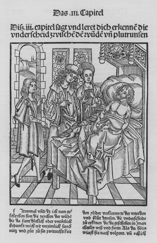Hieronymus Brunschwigin Kirurgian kirja (litho) tekijältä (after) German School