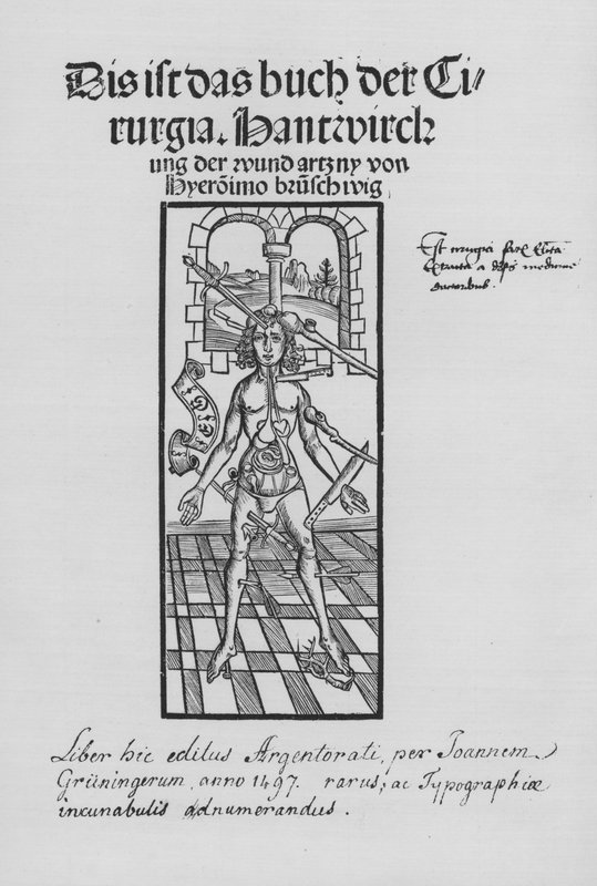 Hieronymus Brunschwigin Kirurgian kirja (litho) tekijältä (after) German School