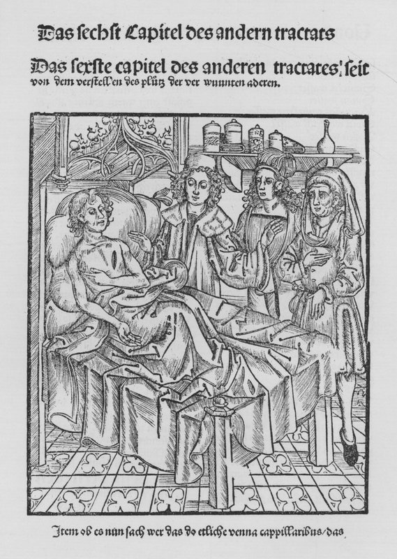 Hieronymus Brunschwigin Kirurgian kirja (litho) tekijältä (after) German School