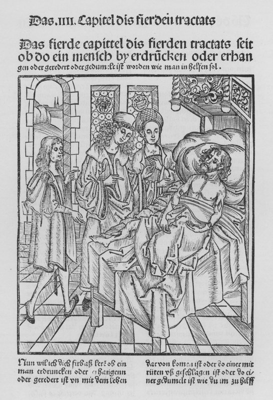Kirurgian kirja, Hieronymus Brunschwig (litho) tekijältä (after) German School