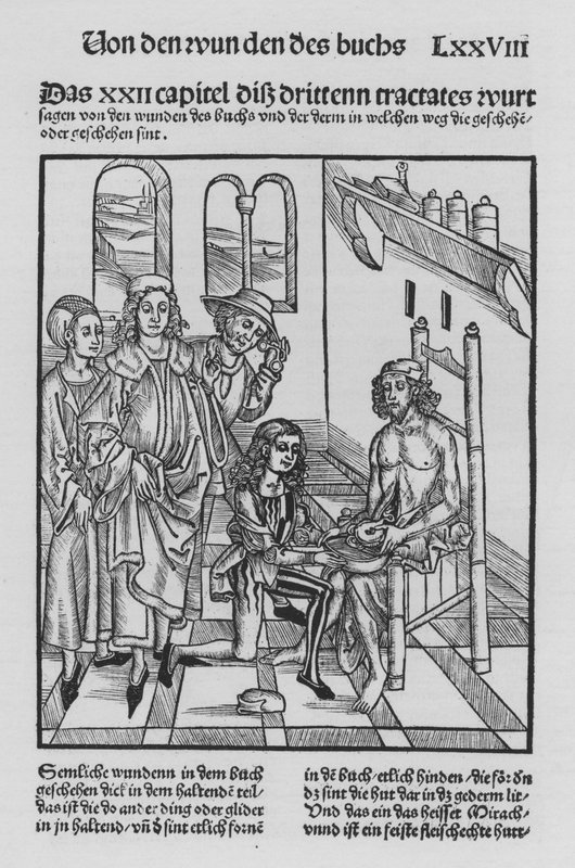 Kirurgian kirja, Hieronymus Brunschwig (litho) tekijältä (after) German School