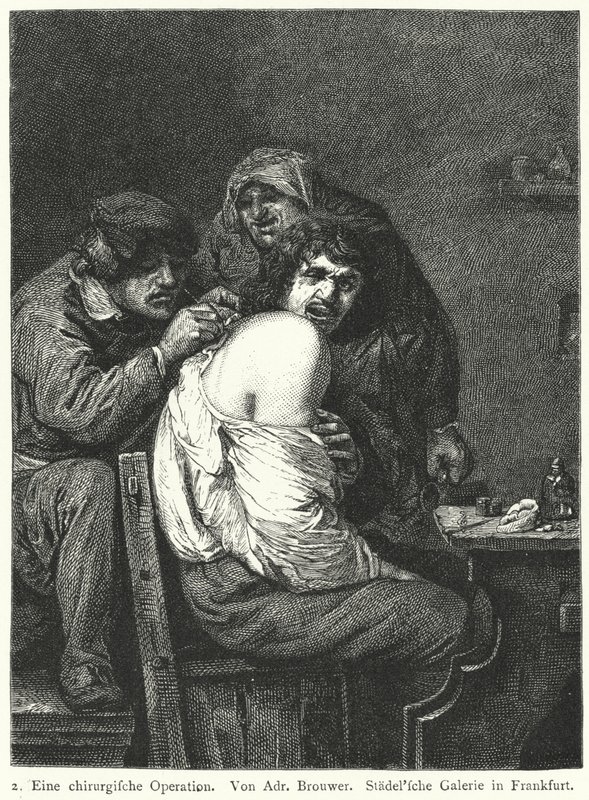 Takaisin operaatio tekijältä Adriaen (after) Brouwer