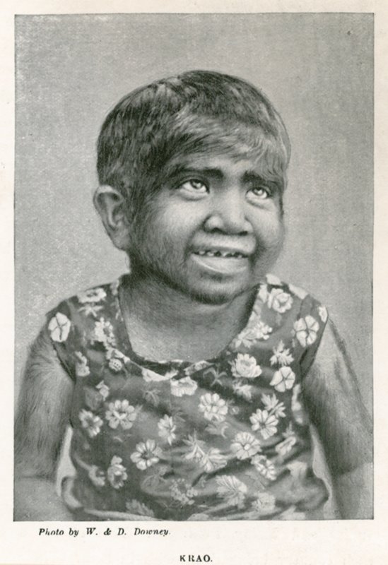 Krao, The Missing Link, esillä Aquariumissa, Westminster, Lontoo, vuonna 1887 tekijältä English Photographer