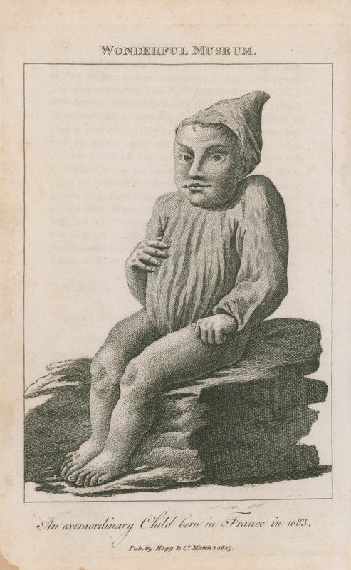 Poikkeuksellinen lapsi syntyi Ranskassa vuonna 1683 tekijältä English School